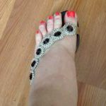 swollen summer feet